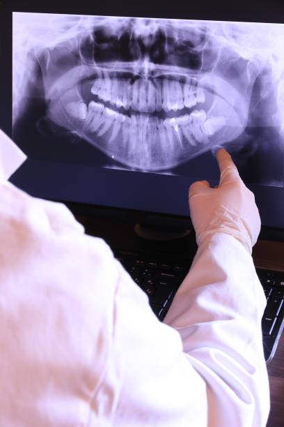 Best Emergency Dentist for Knocked-Out Tooth in San Joaquin, CA
