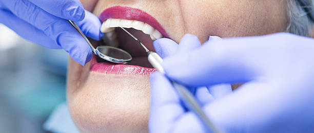 Best Emergency Root Canal Treatment in San Joaquin, CA